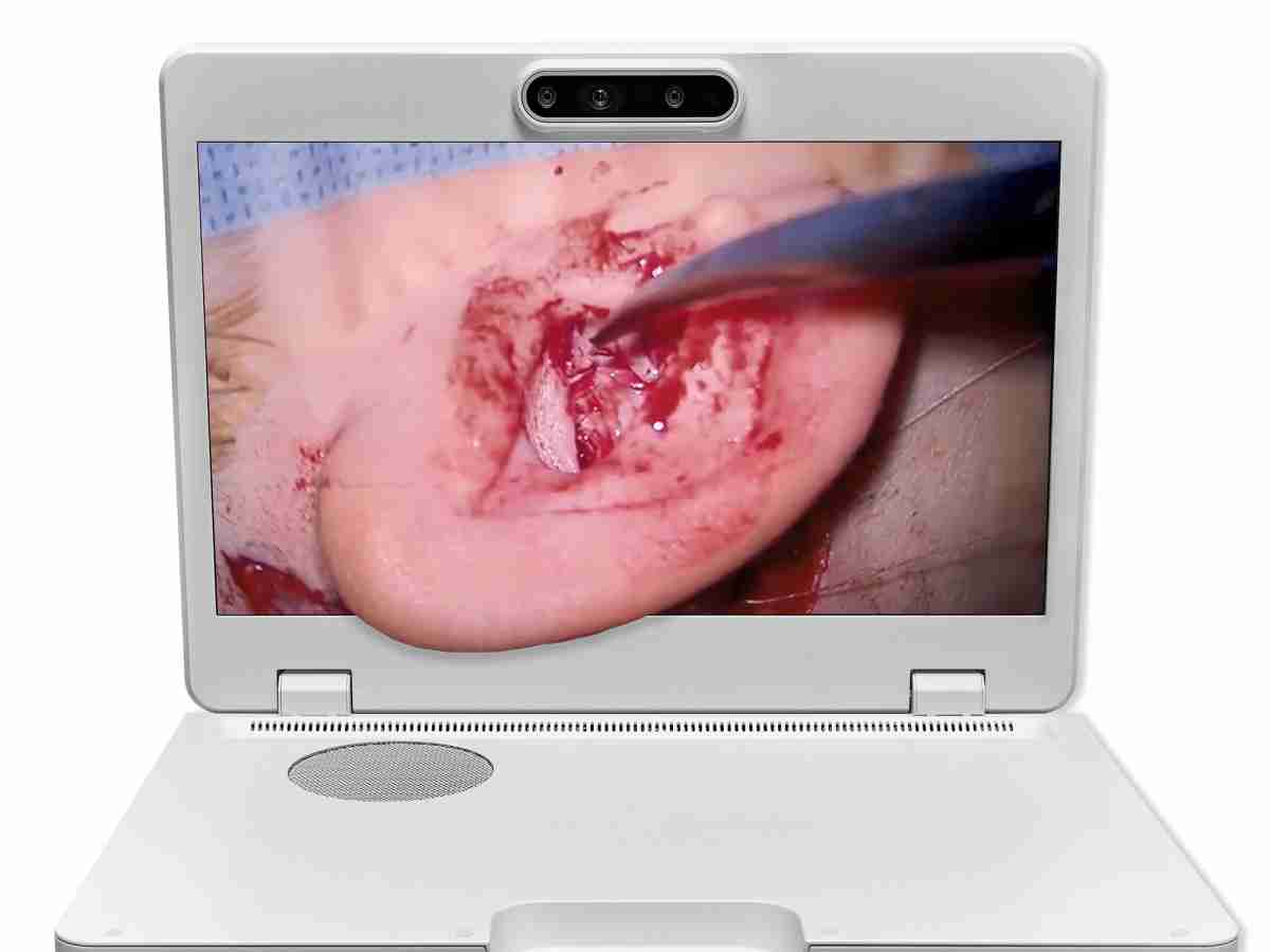 达擎之＂Heads-up 3D显微手术显示系统＂，，，，整合4K裸眼3D显示及眼球追踪系统，，，具备快速追踪人眼移动位置功能，，，减轻医师长时间维持固定姿势的负担，，，，让医师能有更宽广清晰的3D立体视野及更舒适的姿势来执行手术。。。